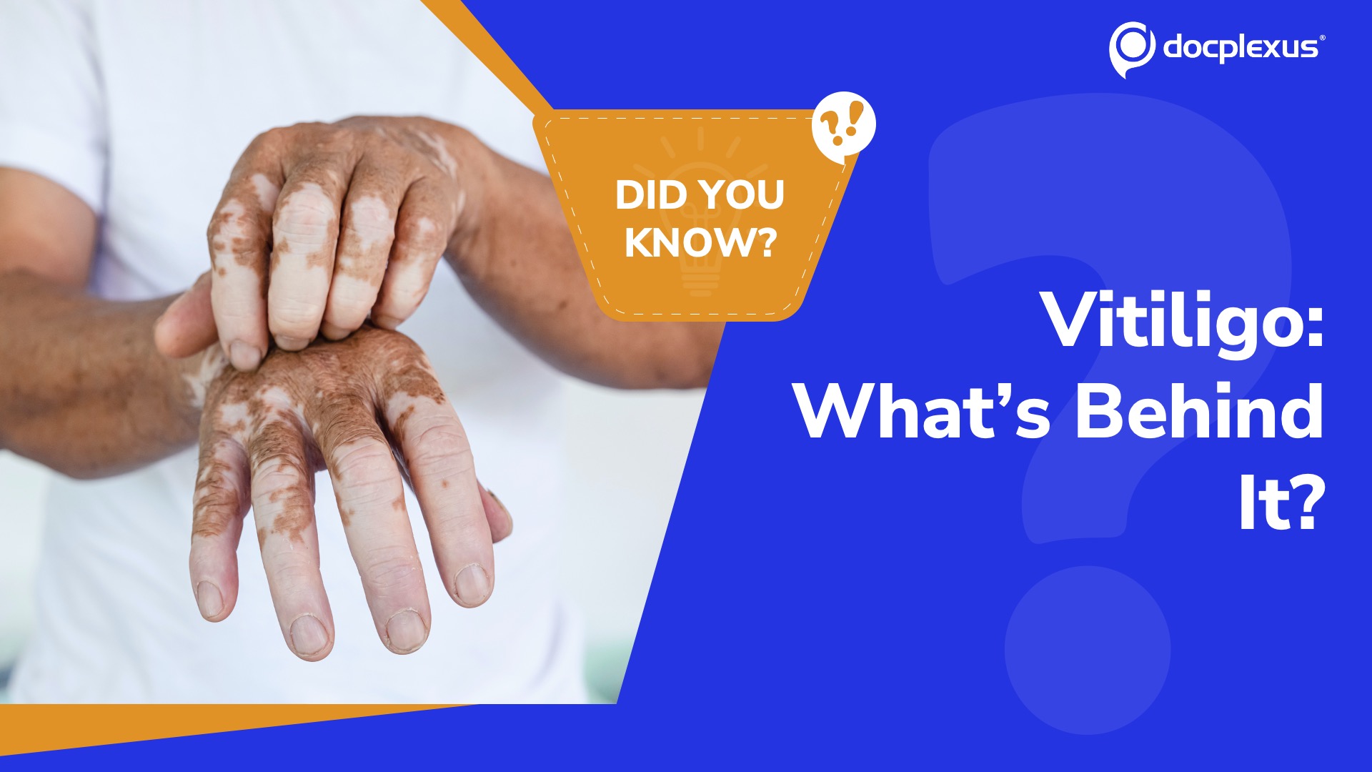 Cracking Vitiligo: Can You Identify the Core Mechanism?