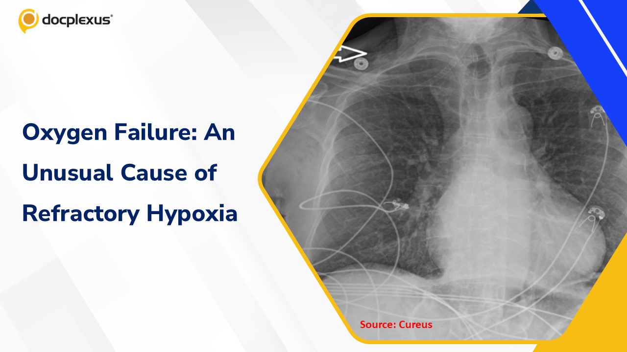 When Oxygen Fails: Evaluating an Unusual Cause of Refractory Hypoxia