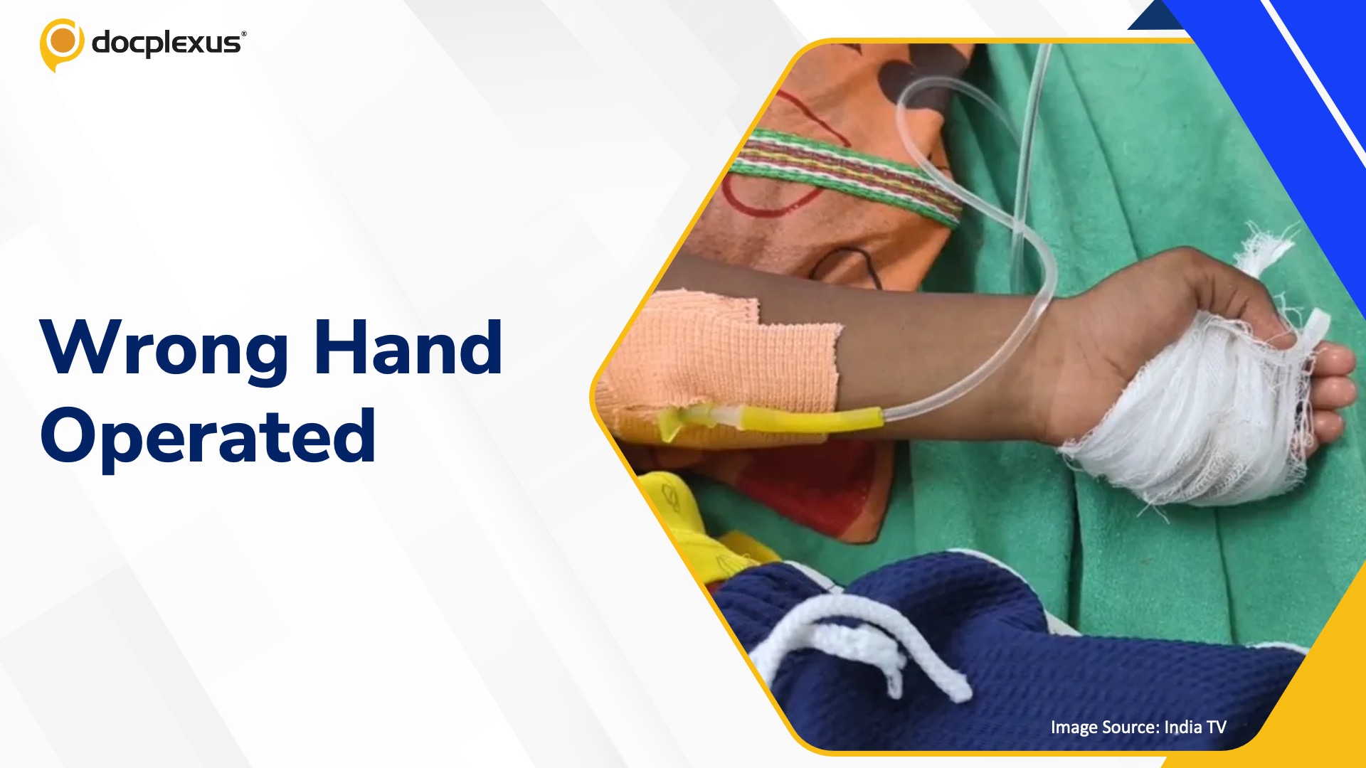 Wrong-Hand Surgery in Child Sparks Probe at Maharashtra Hospital