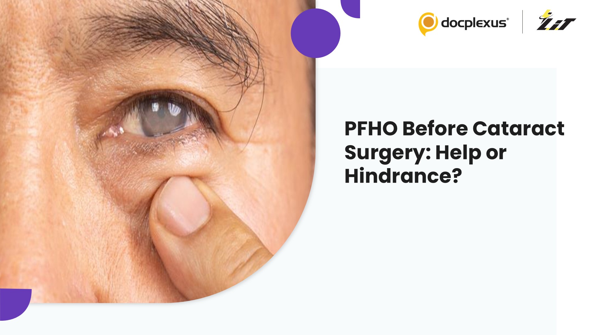 Is PFHO a Boon or a Risk in Cataract Surgery for Dry Eye Patients?