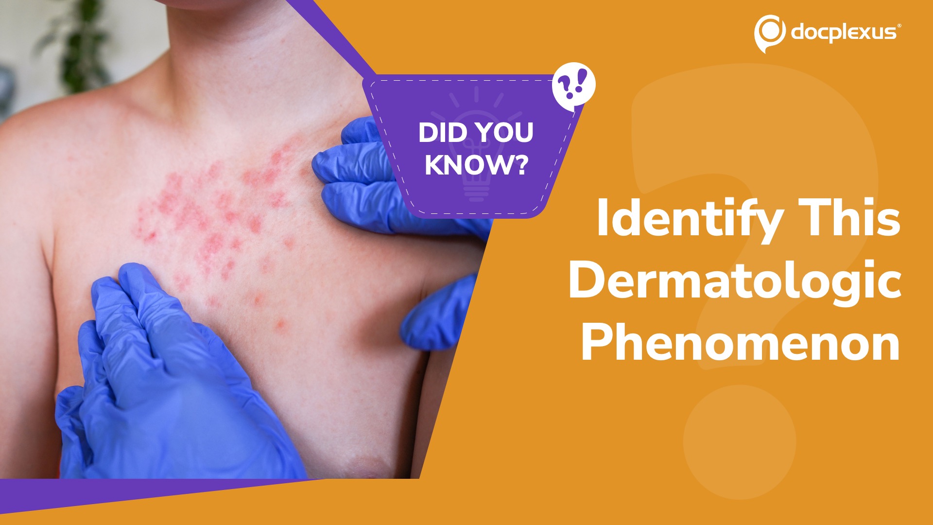 When Skin Trauma Triggers Disease: Can You Name This Phenomenon?