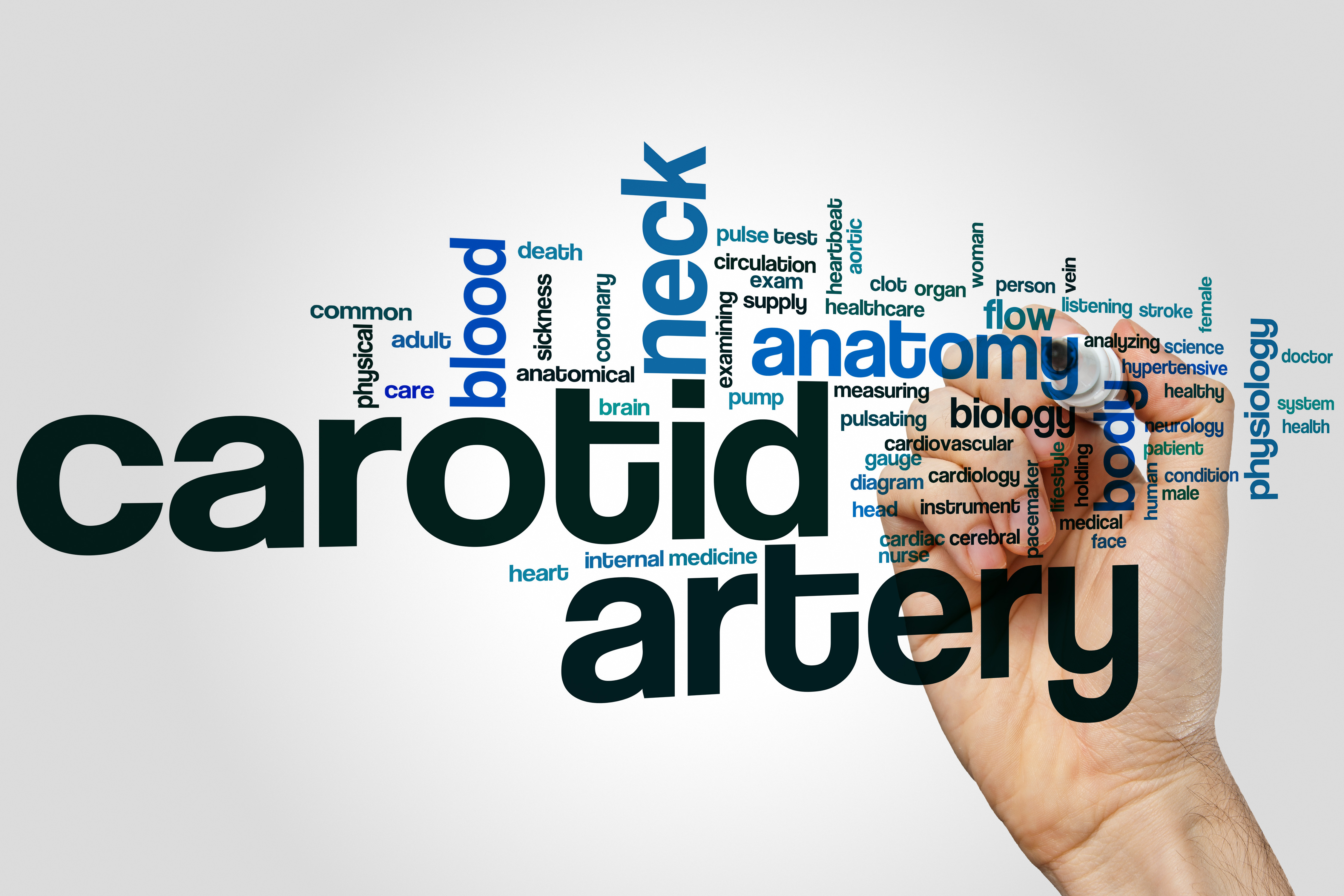 Rare Case: Congenital Absence of Right Internal Carotid Artery