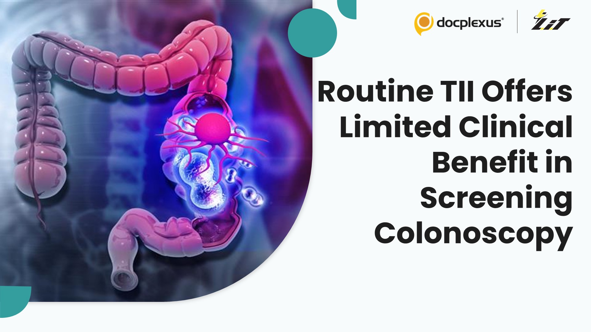Routine Terminal Ileal Intubation Shows Minimal Diagnostic Yield in Asymptomatic Patients Undergoing Screening Colonoscopy