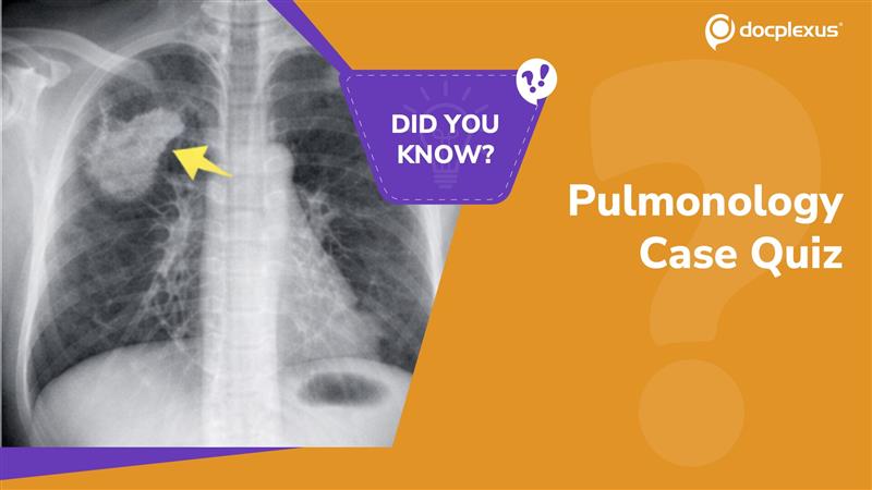 Pulmonology Case Quiz