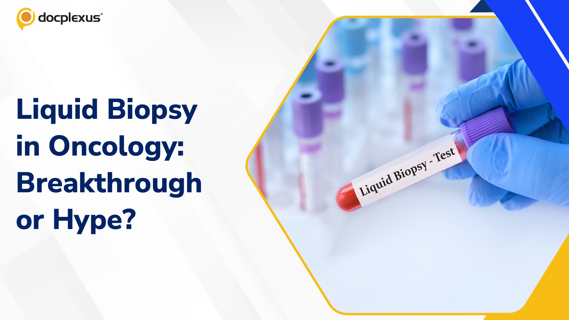 Liquid Biopsy in Early Cancer Detection: Clinical Promise and Current Limitations