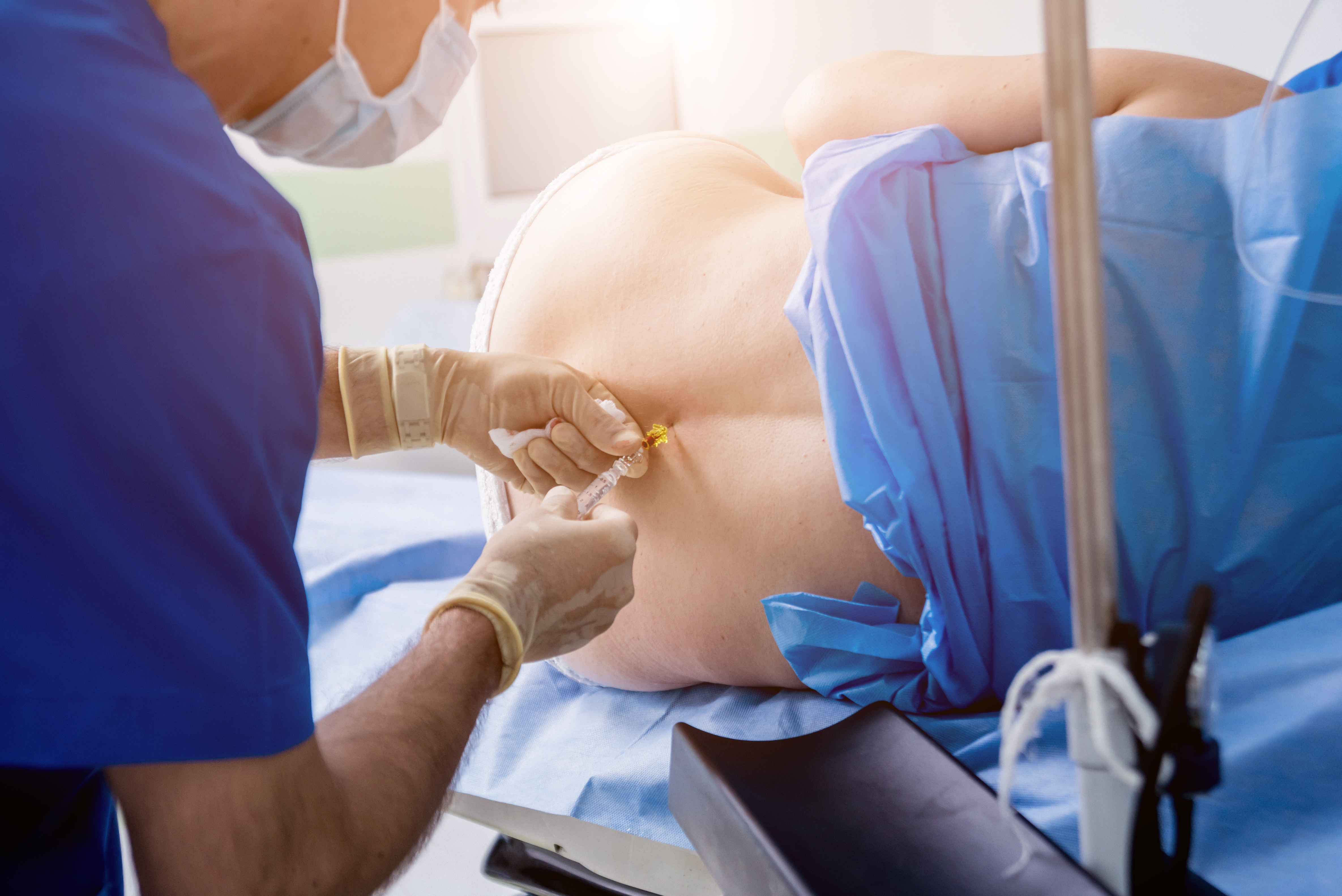Clonidine and Dexmedetomidine as Adjuvants in Obstetric Anesthesia