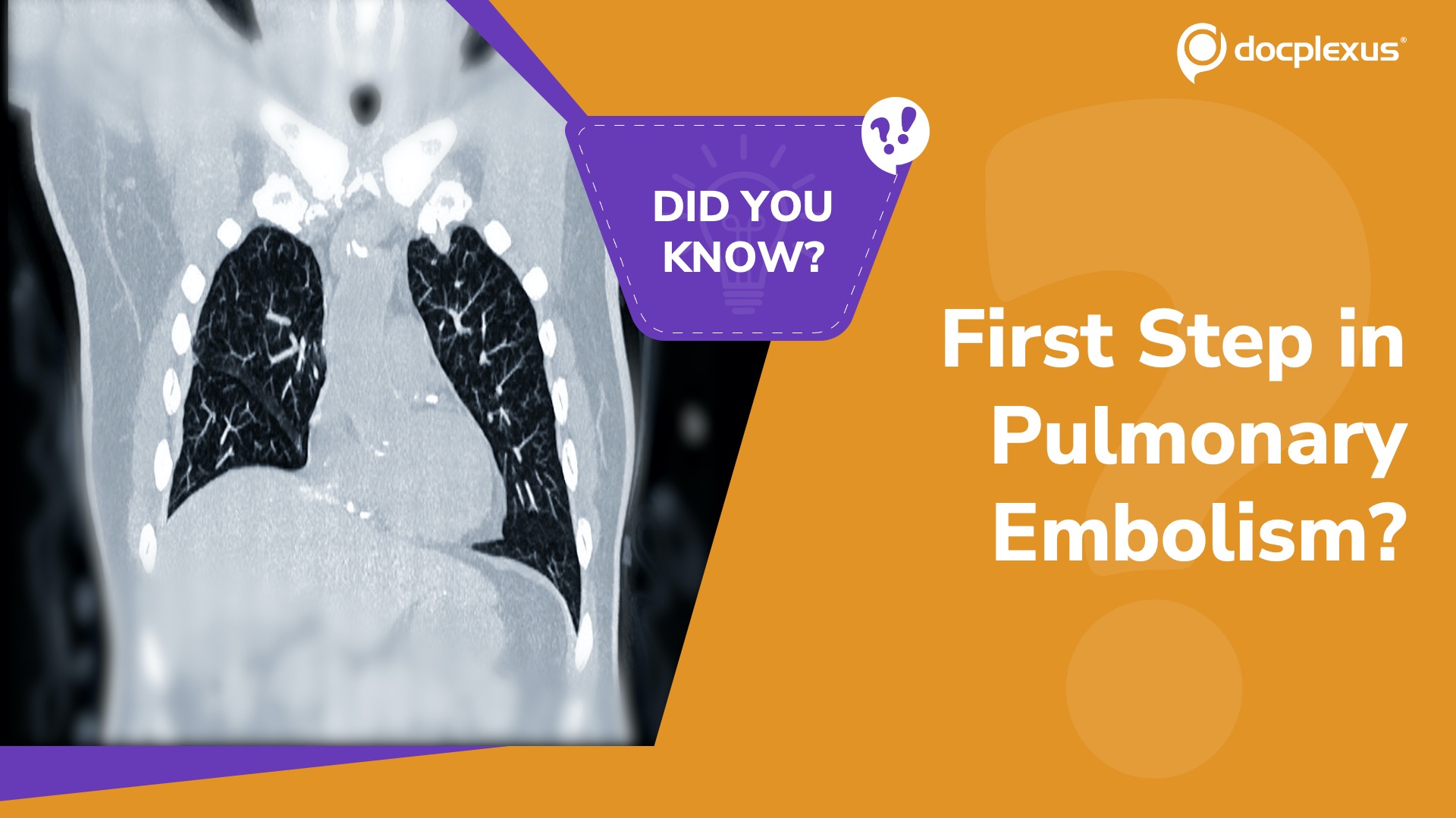 Pulmonary Embolism: Are You Choosing the Right First Therapy?