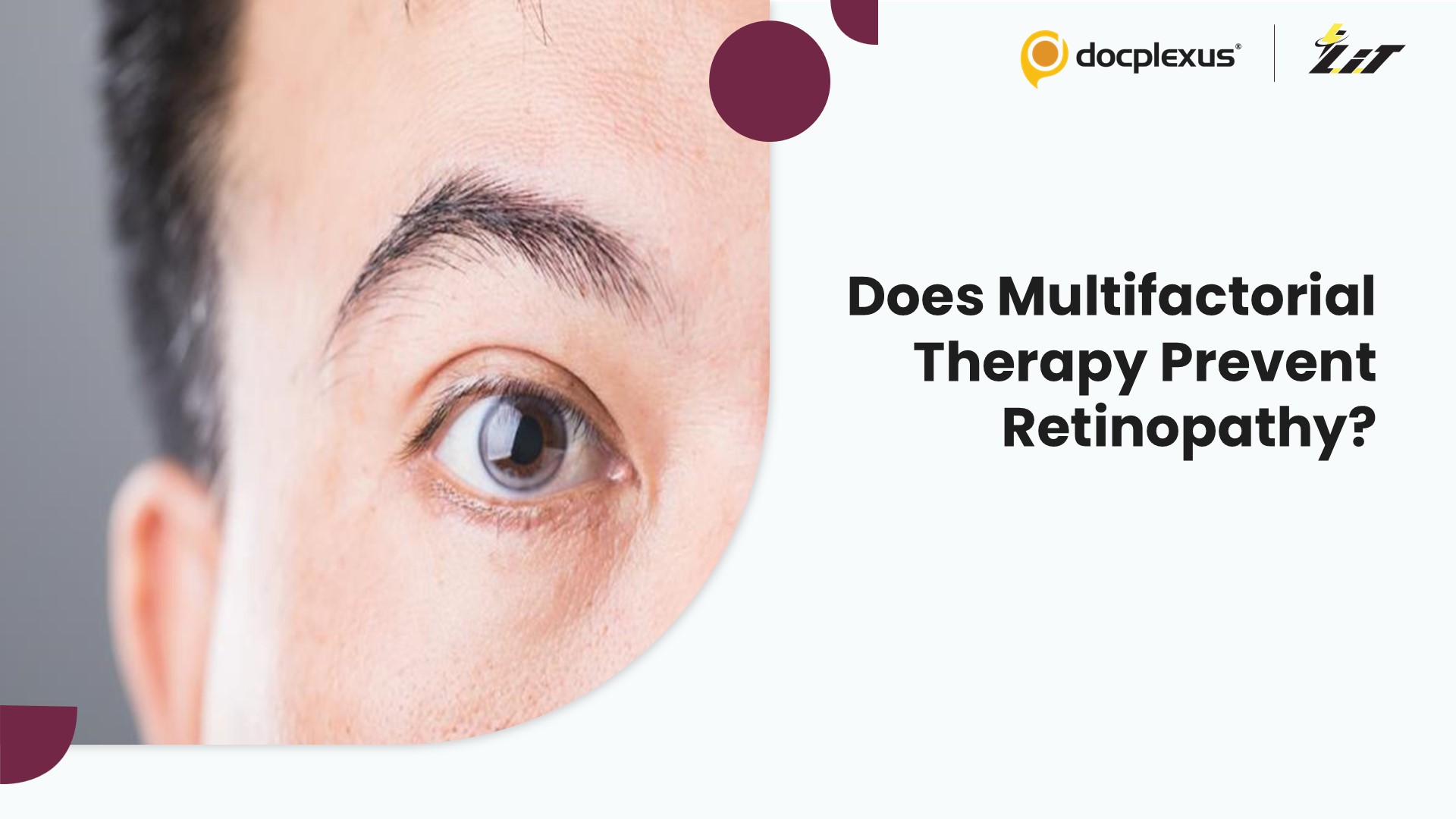 Is Multifactorial Intervention Really Effective for Preventing Retinopathy in Type 2 Diabetes?