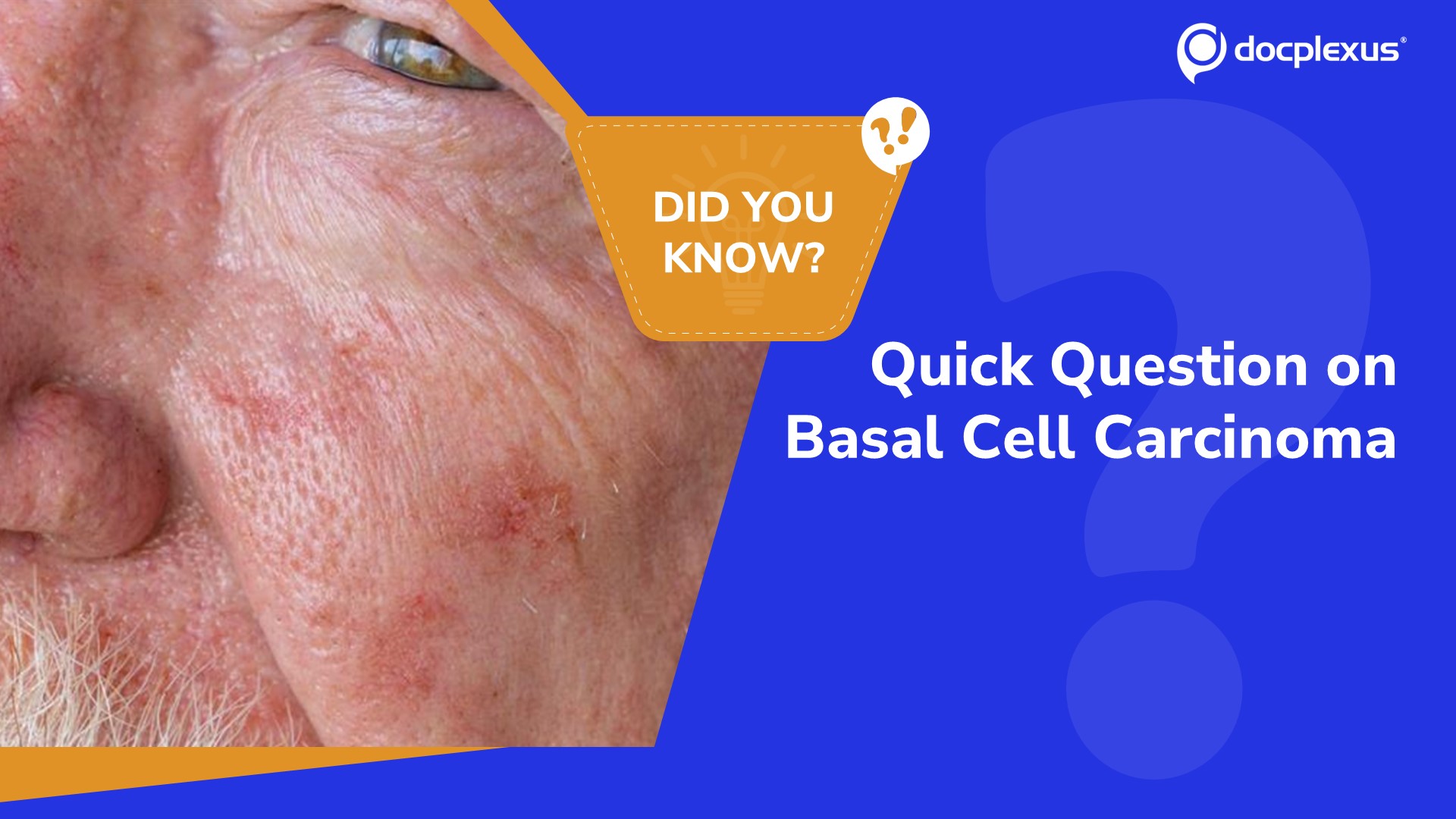 Basal Cell Carcinoma: Overview & Rapid Review Quiz