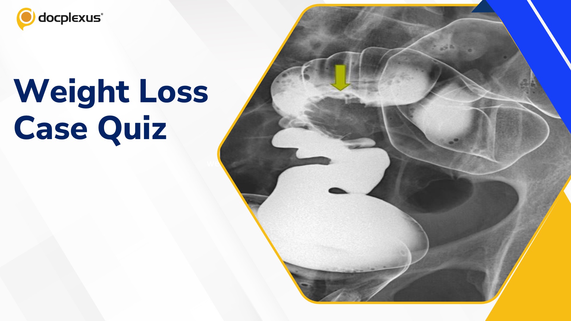 weight loss Case Quiz
