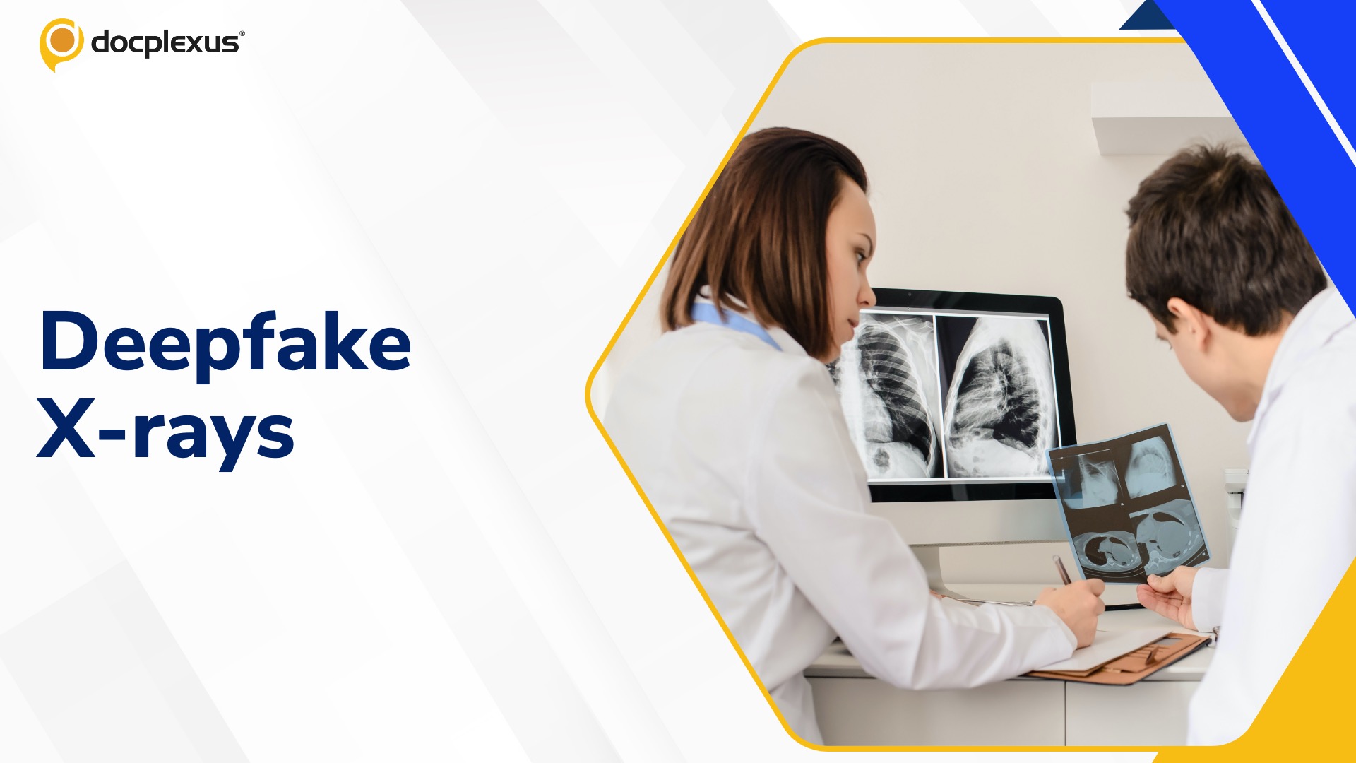 Radiologists and AI Struggle to Spot Deepfake X-rays