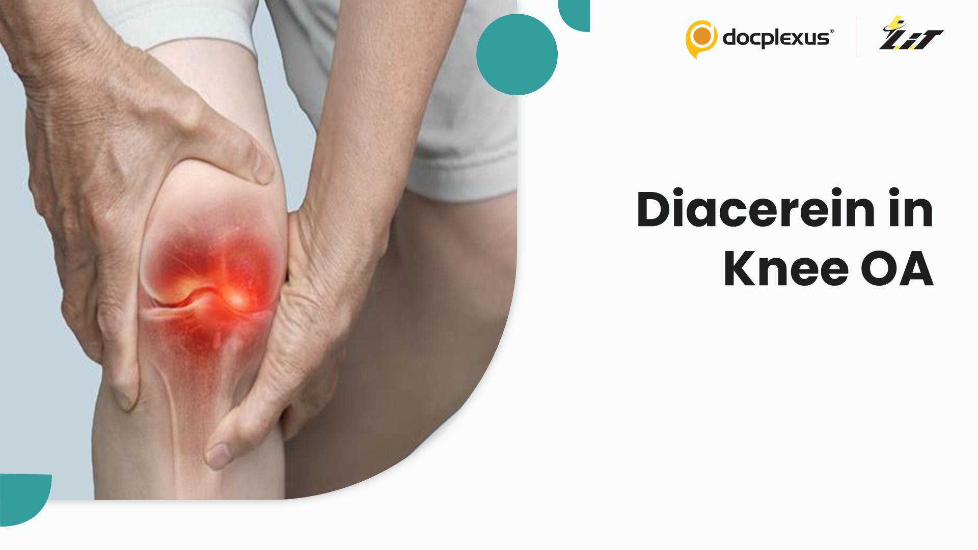 Diacerein in Knee Osteoarthritis: Does It Work?