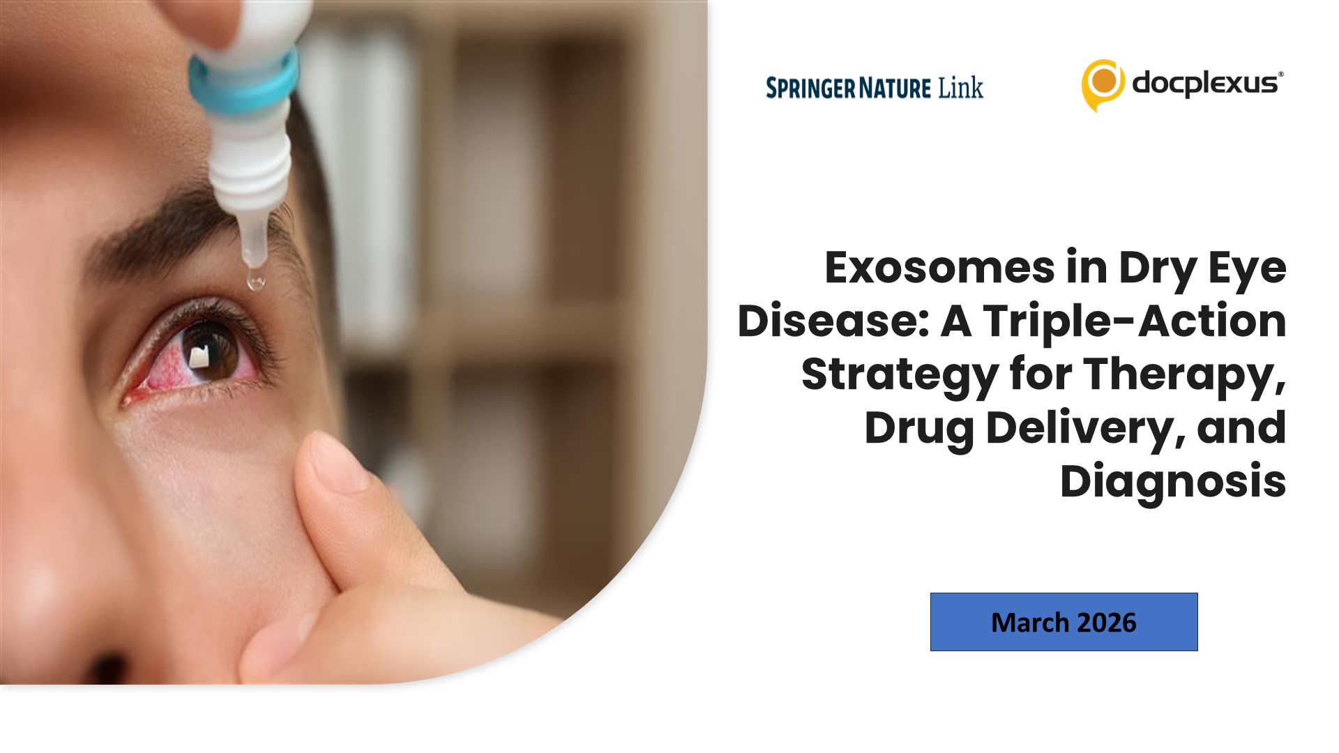 Exosomes in Dry Eye Disease: A Triple-Action Strategy for Therapy, Drug Delivery, and Diagnosis