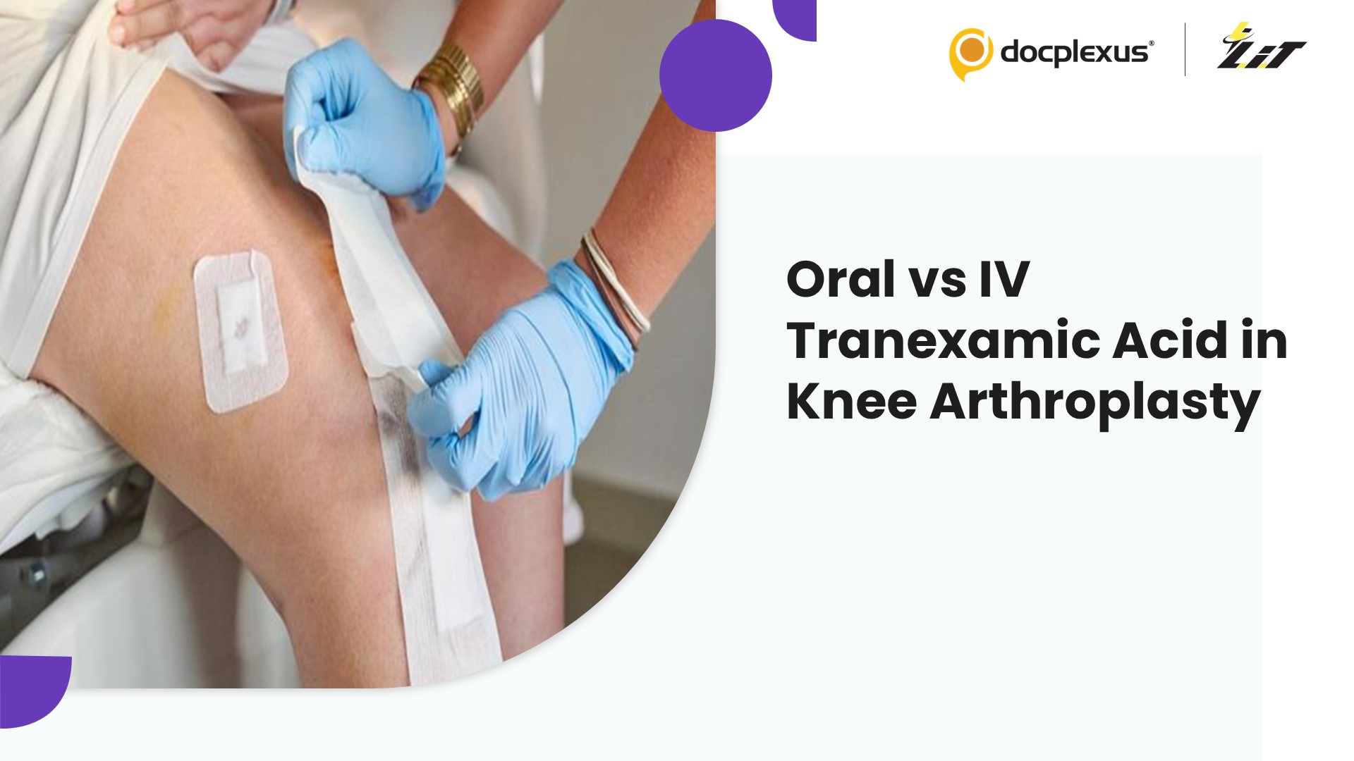 Oral vs Intravenous Tranexamic Acid in Knee Arthroplasty: Key Insights