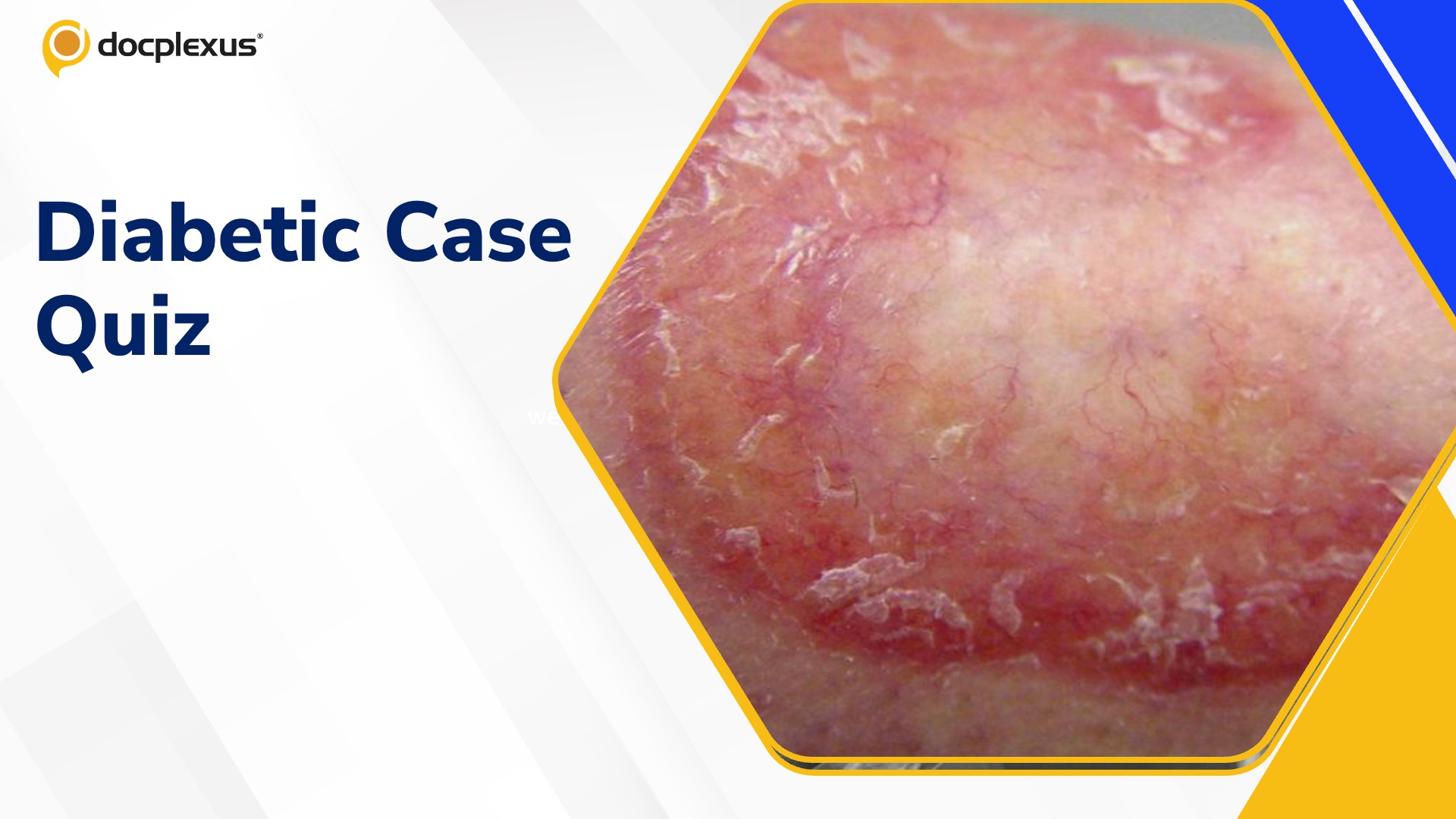 Diabetic Case Quiz