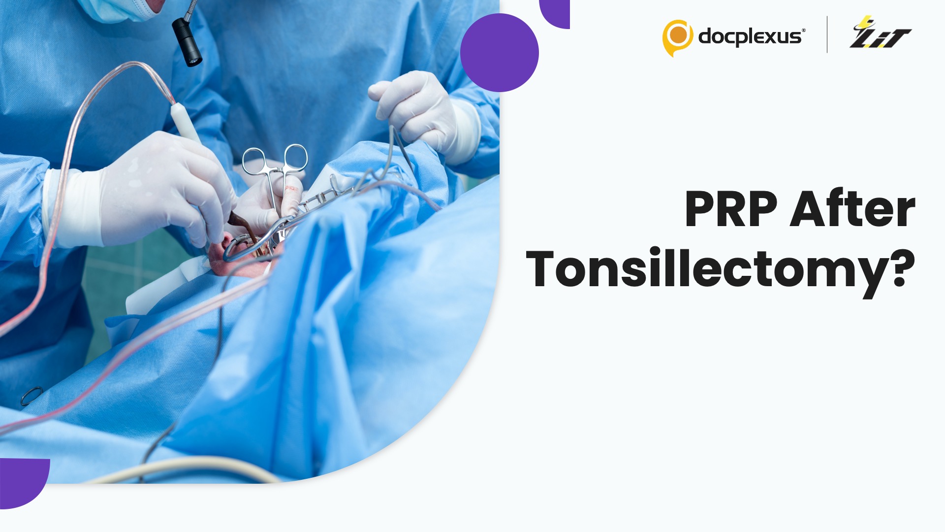 Platelet-Rich Plasma for Post-Tonsillectomy Recovery