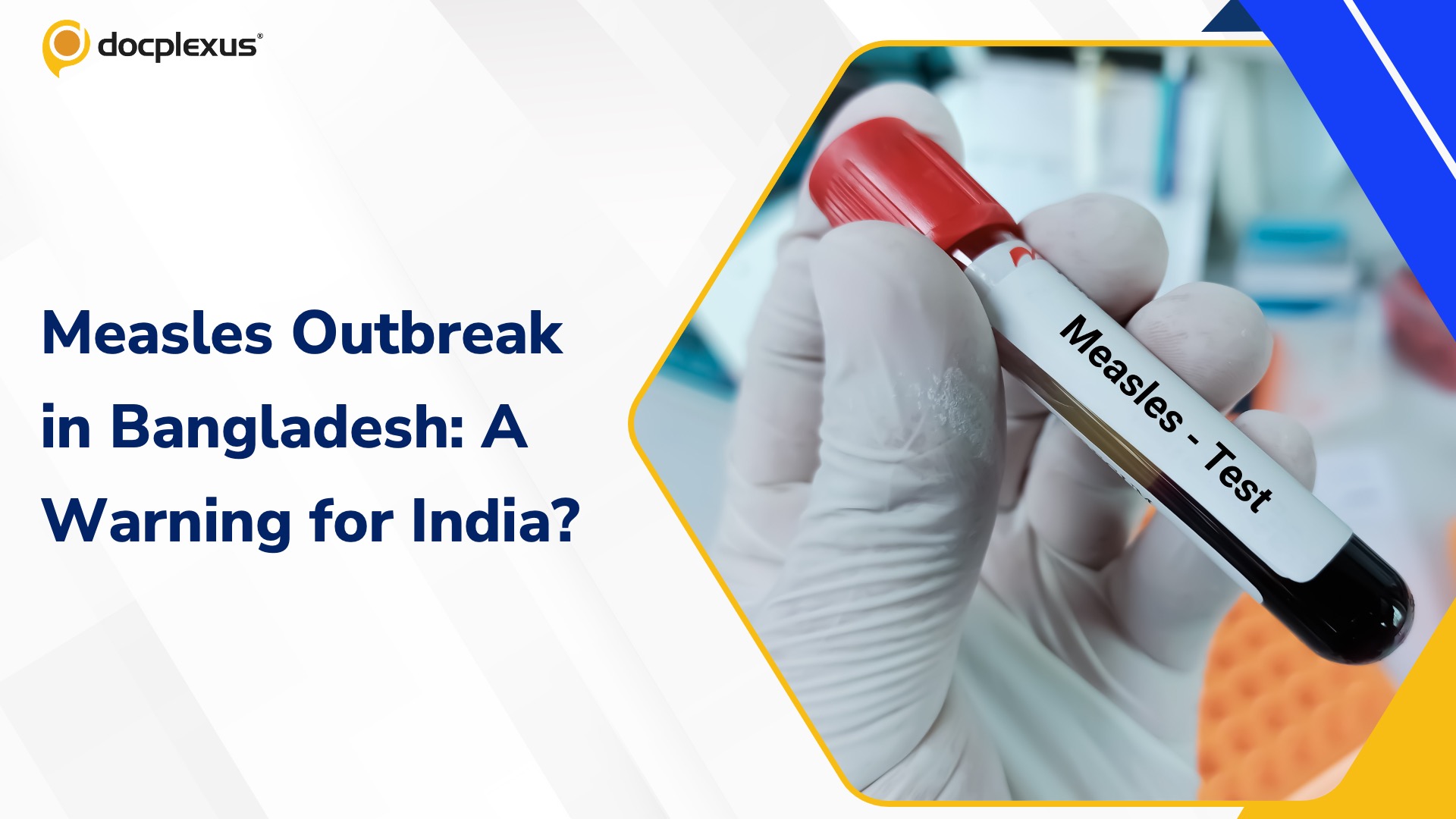 Measles Surge in Bangladesh: A Wake-Up Call for Indian Clinicians