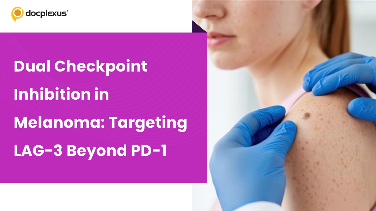 Dual Checkpoint Inhibition in Melanoma: Targeting LAG-3 Beyond PD-1
