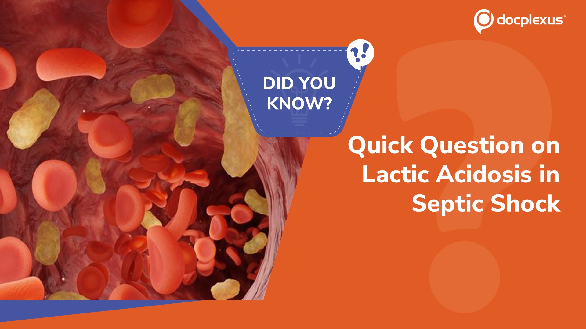 Assess Your Knowledge of Lactic Acidosis in Septic Shock