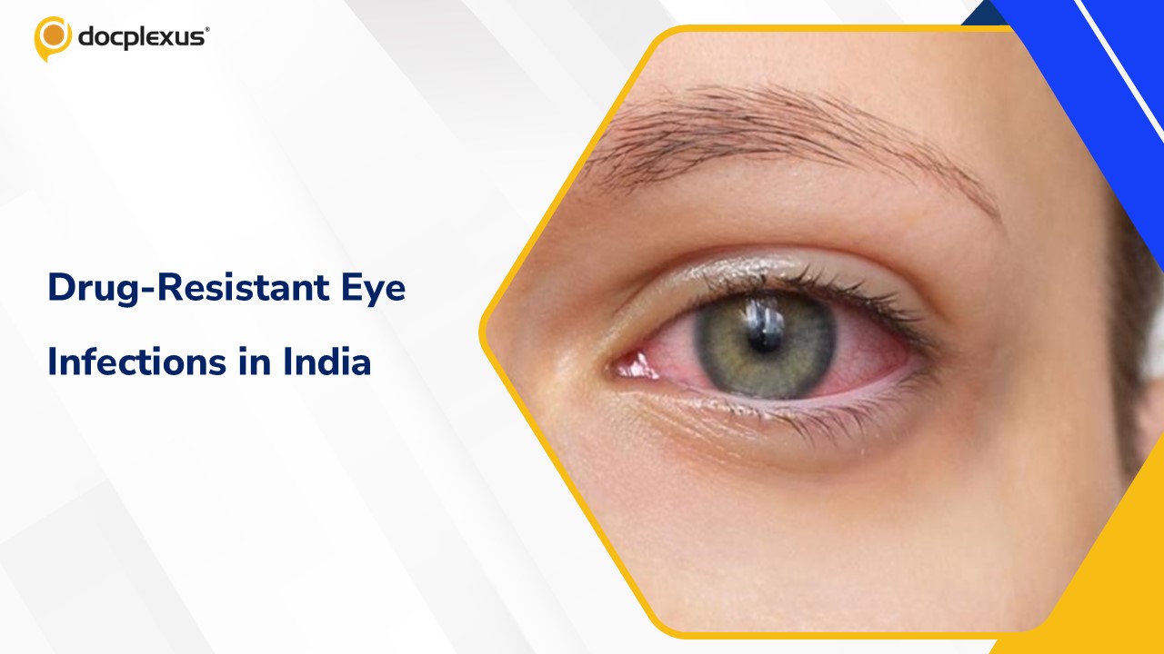 Rising Antimicrobial Resistance in Eye Infections: A Landmark Genomic Study from India