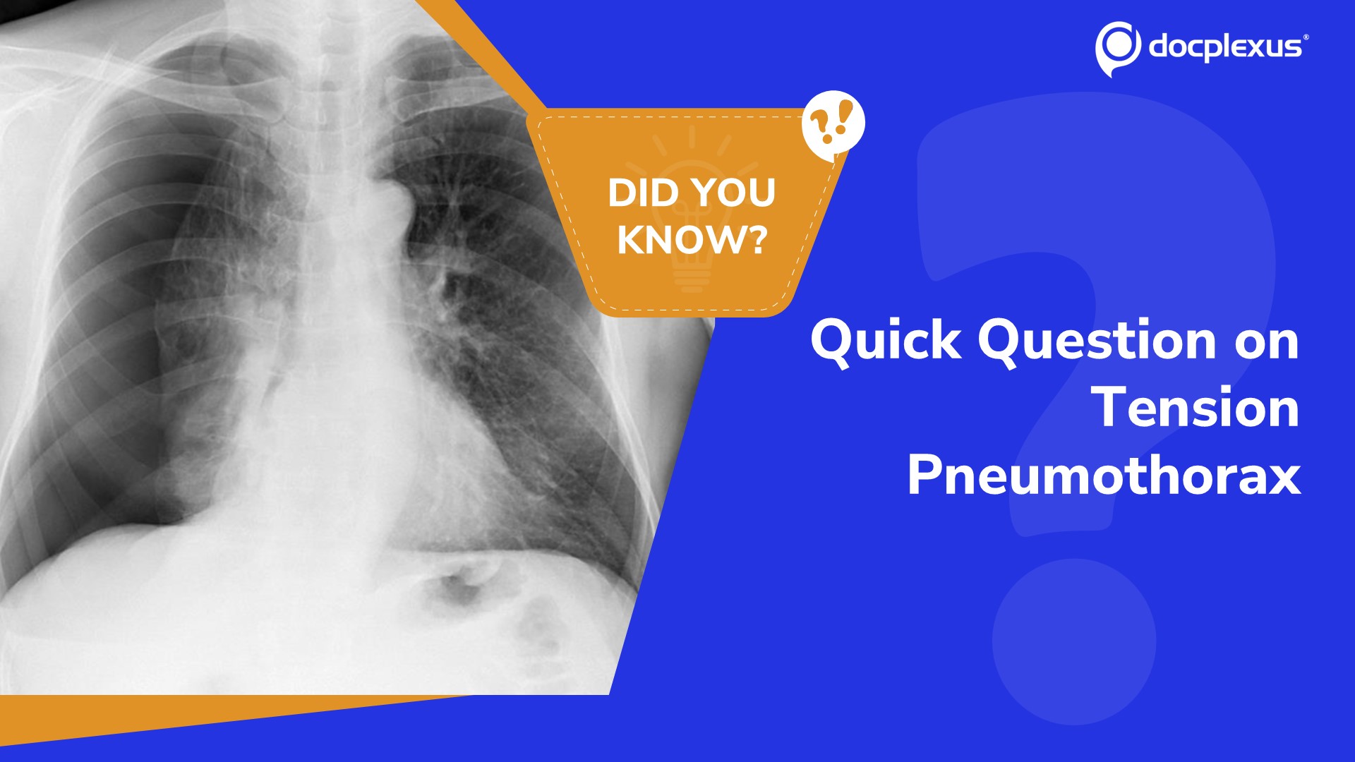 How Well Do You Know Tension Pneumothorax?