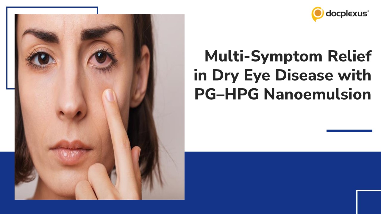 PG–HPG Nanoemulsion: Enabling Multi-Symptom Relief in Dry Eye Disease