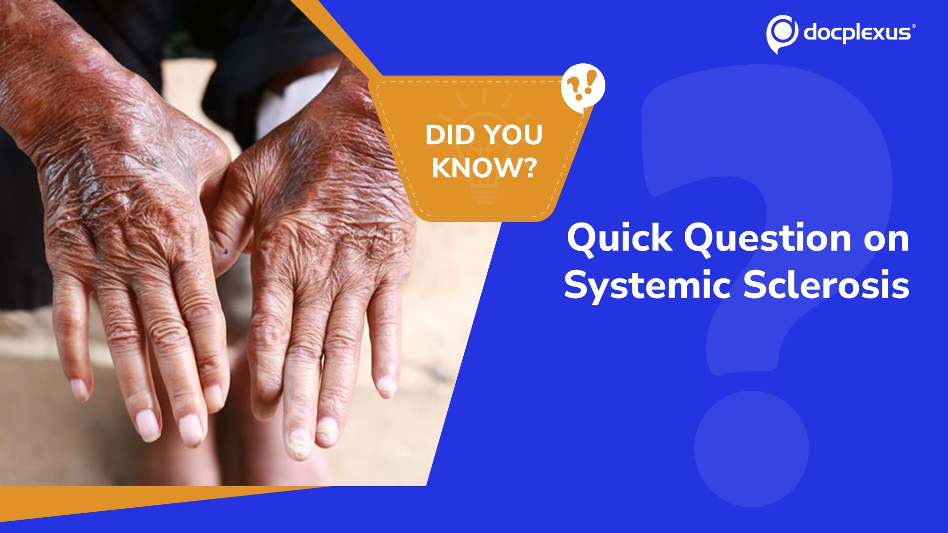 Challenge Your Knowledge of Systemic Sclerosis!