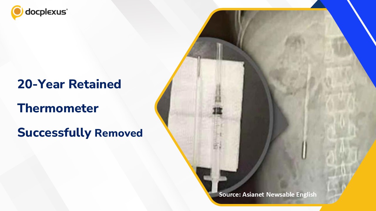 After 20 Years: Successful Surgical Removal of a Retained Duodenal Thermometer