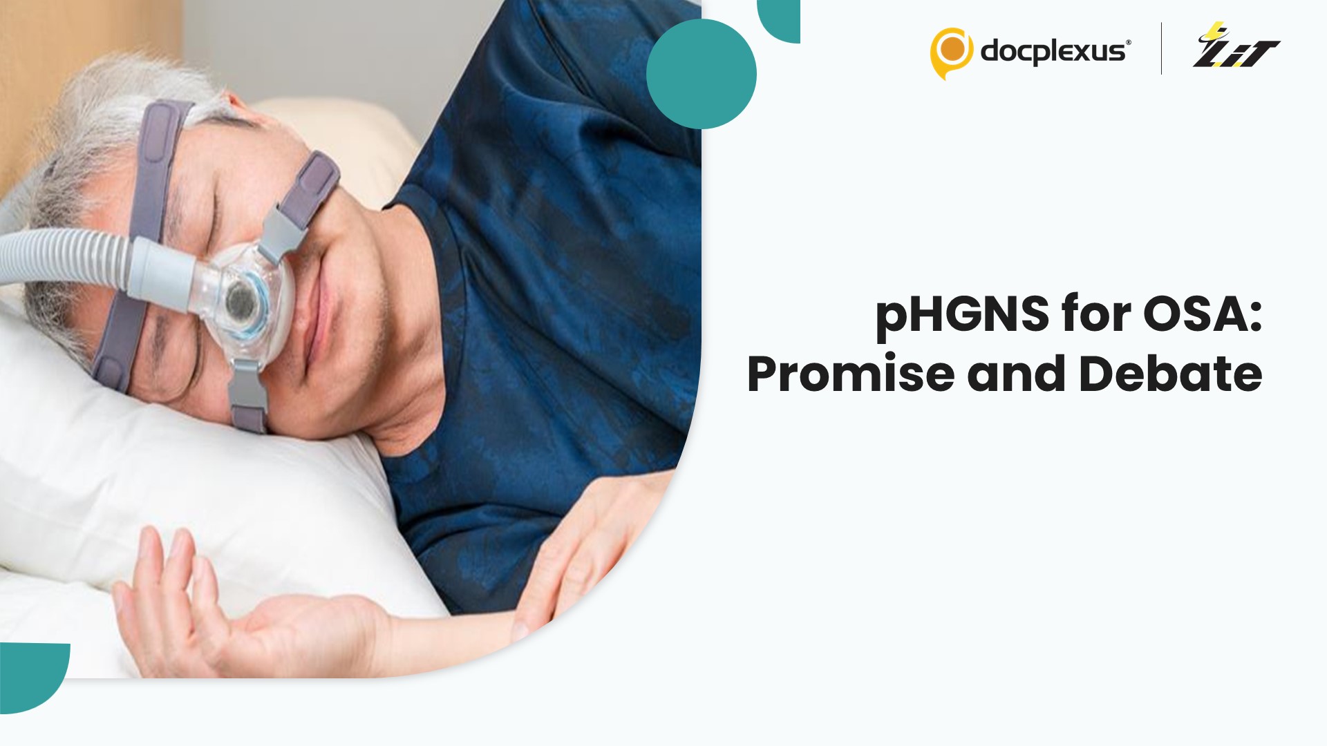 pHGNS for OSA: A Promising Yet Debated Therapy
