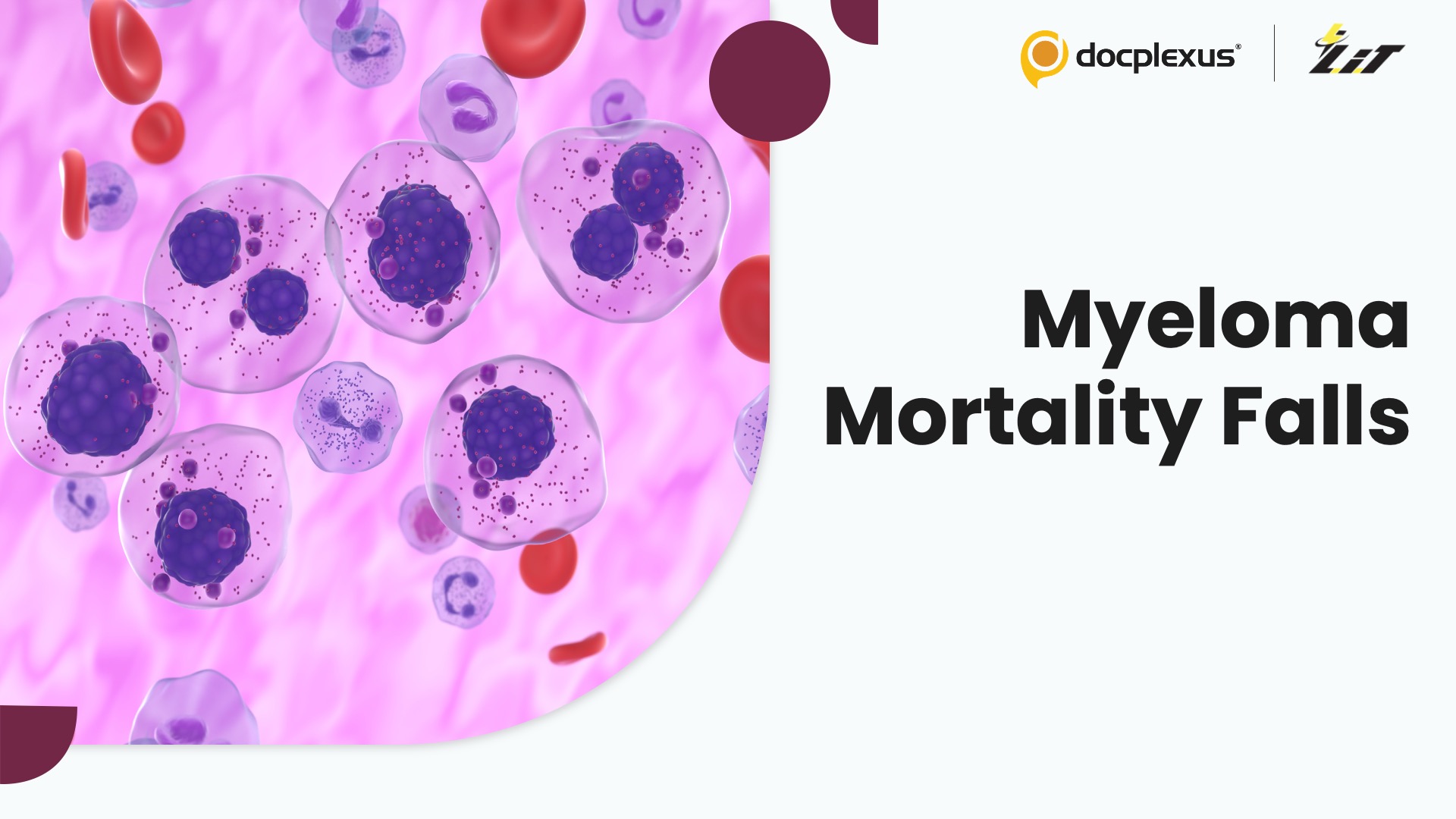 Multiple Myeloma Mortality Drops Sharply as Novel Therapies Reshape Outcomes