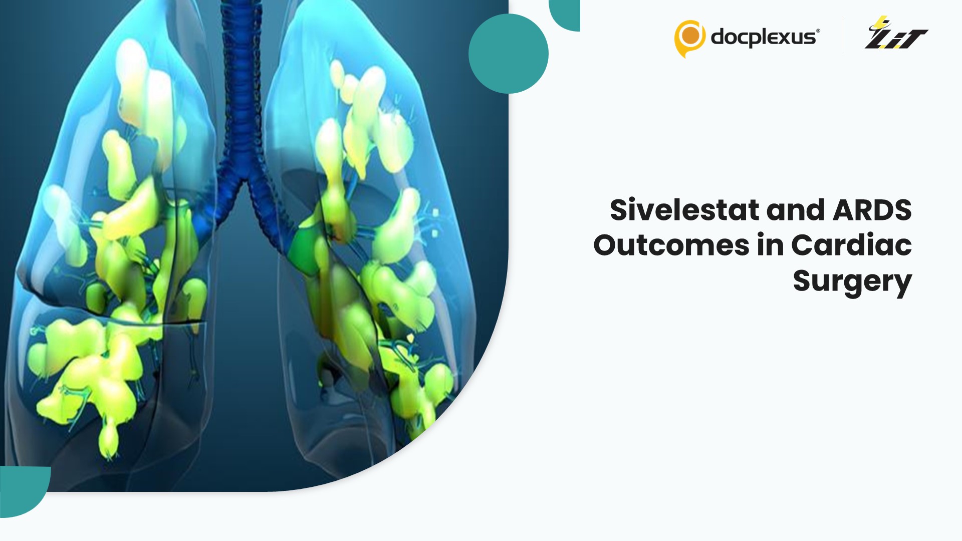 Sivelestat in Cardiovascular Surgery: Effects on ARDS and Clinical Outcomes