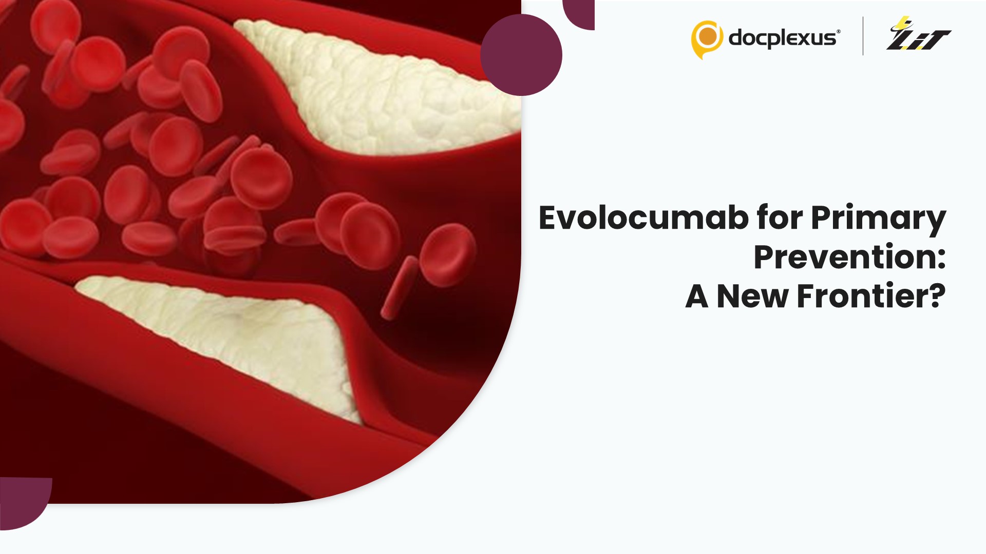 Can Evolocumab Redefine Primary Prevention Beyond Established Atherosclerosis?