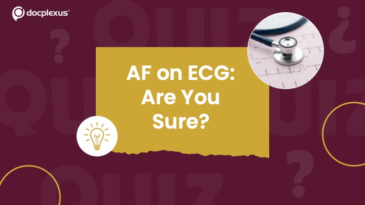 Atrial Fibrillation: Easy to Miss, Hard to Ignore