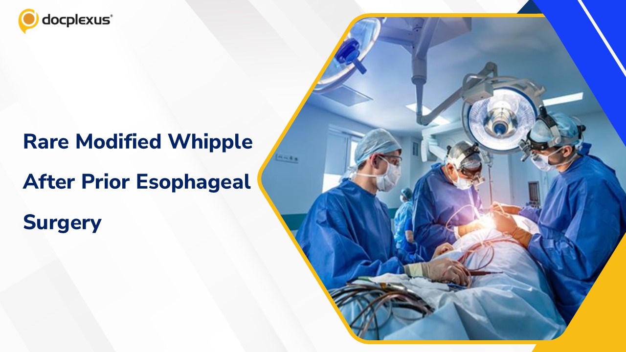 Delhi Doctors Perform Rare Modified Whipple Surgery in Patient With Prior Esophageal Cancer Surgery