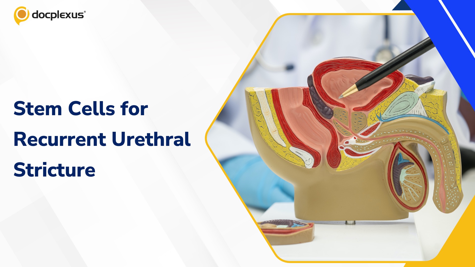 Bengaluru Doctors Use Stem Cell Therapy to Treat Recurrent Urethral Stricture