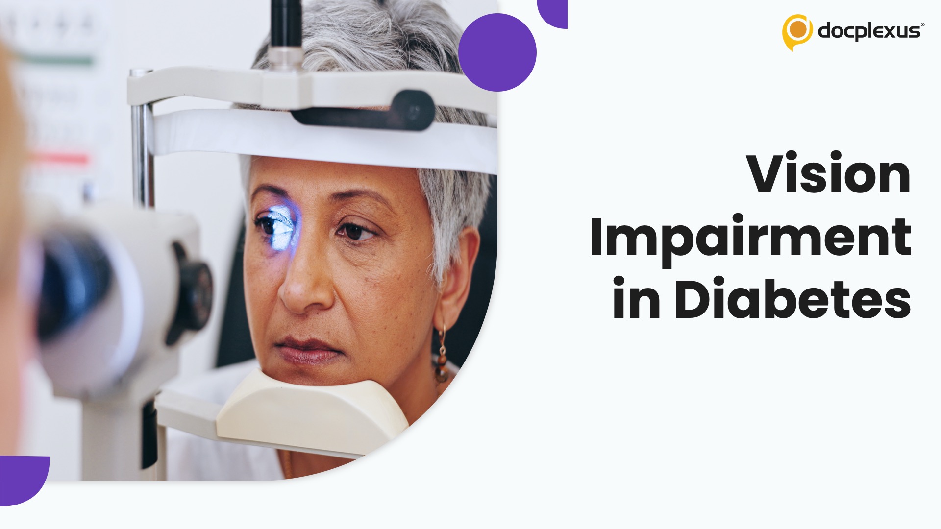 Diabetes and Vision Loss: Uncovering Hidden Demographic Disparities