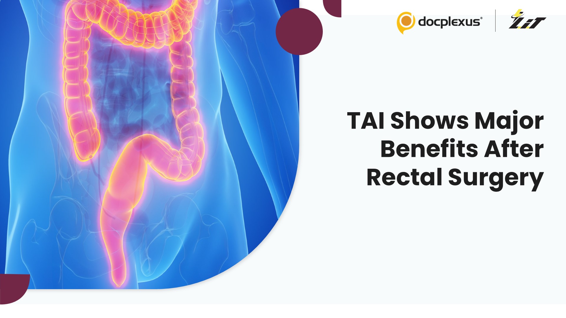 Transanal Irrigation Improves Outcomes in Low Anterior Resection Syndrome