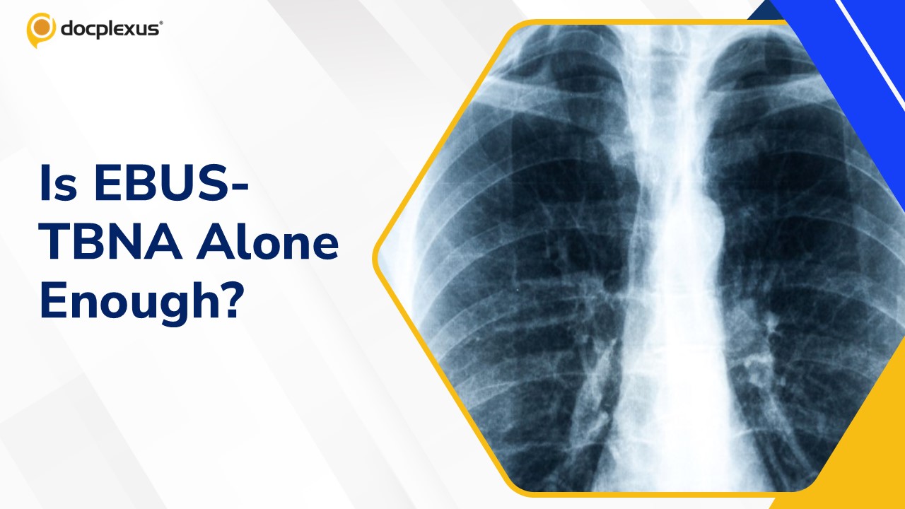 Is EBUS-TBNA Alone No Longer Enough for Mediastinal Lesion Diagnosis?