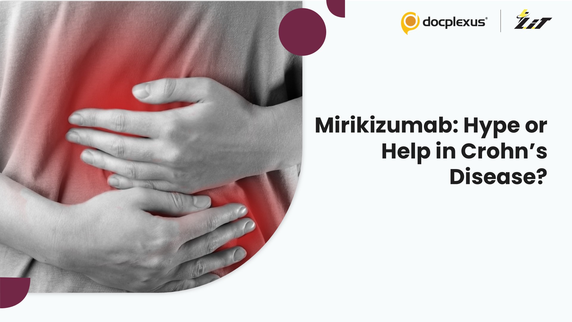 Mirikizumab for Bowel Urgency in Crohn’s Disease: Breakthrough or Overstated Benefit?