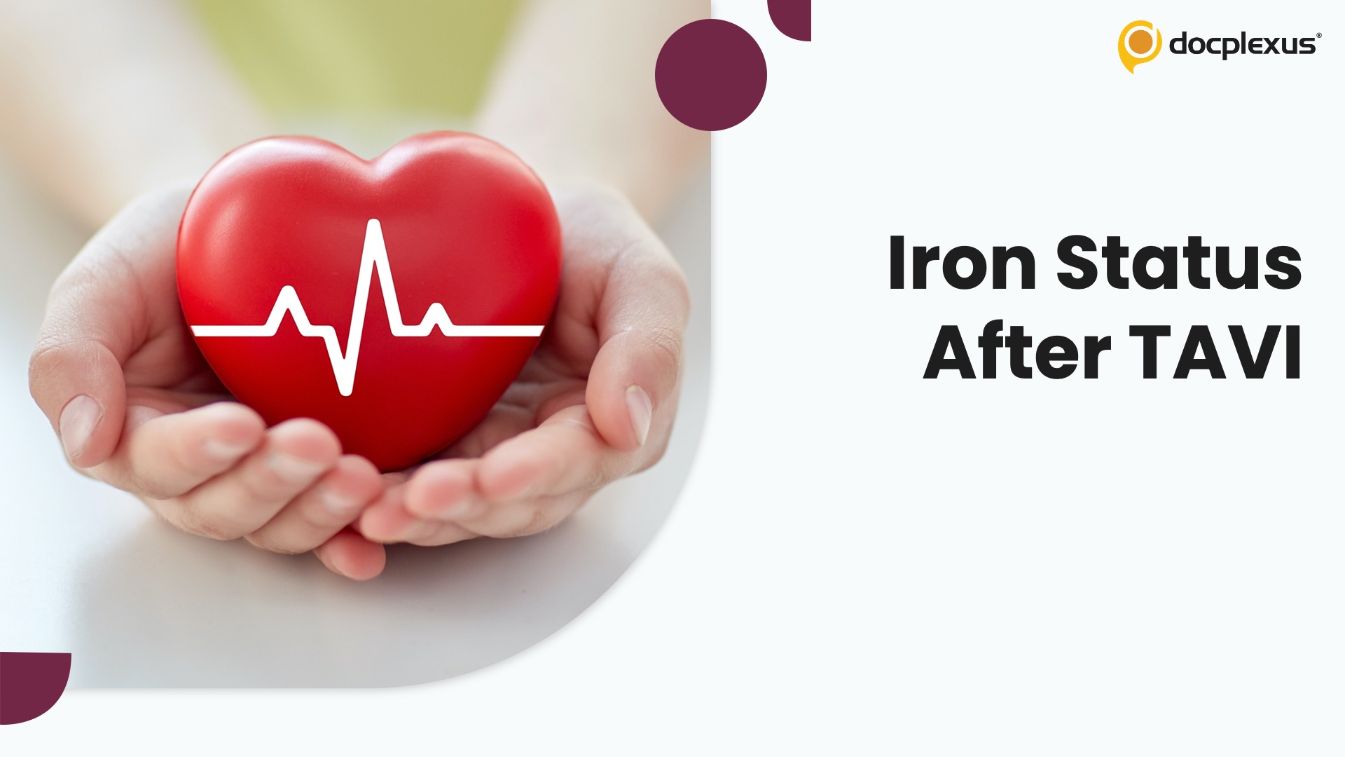 Iron Deficiency in Aortic Stenosis: Hidden Driver of Myocardial Dysfunction?