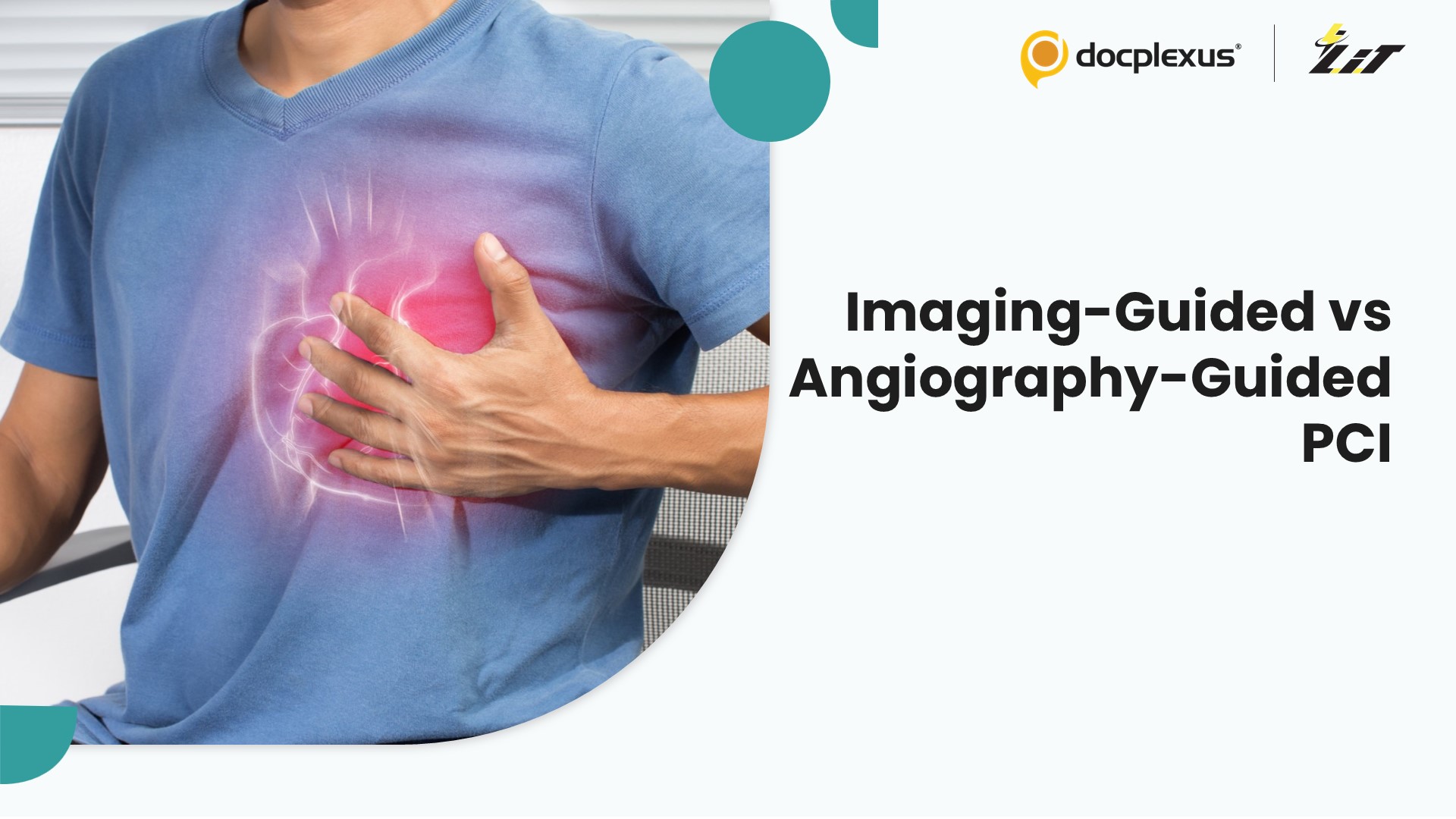 Intravascular Imaging-Guided vs Angiography-Guided PCI for Complex Coronary Lesions