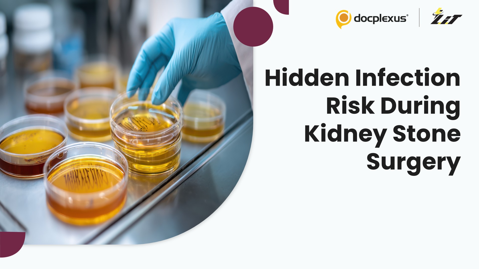 Can Intraoperative Urine Cultures Predict Infection Risk After Flexible Ureteroscopy?