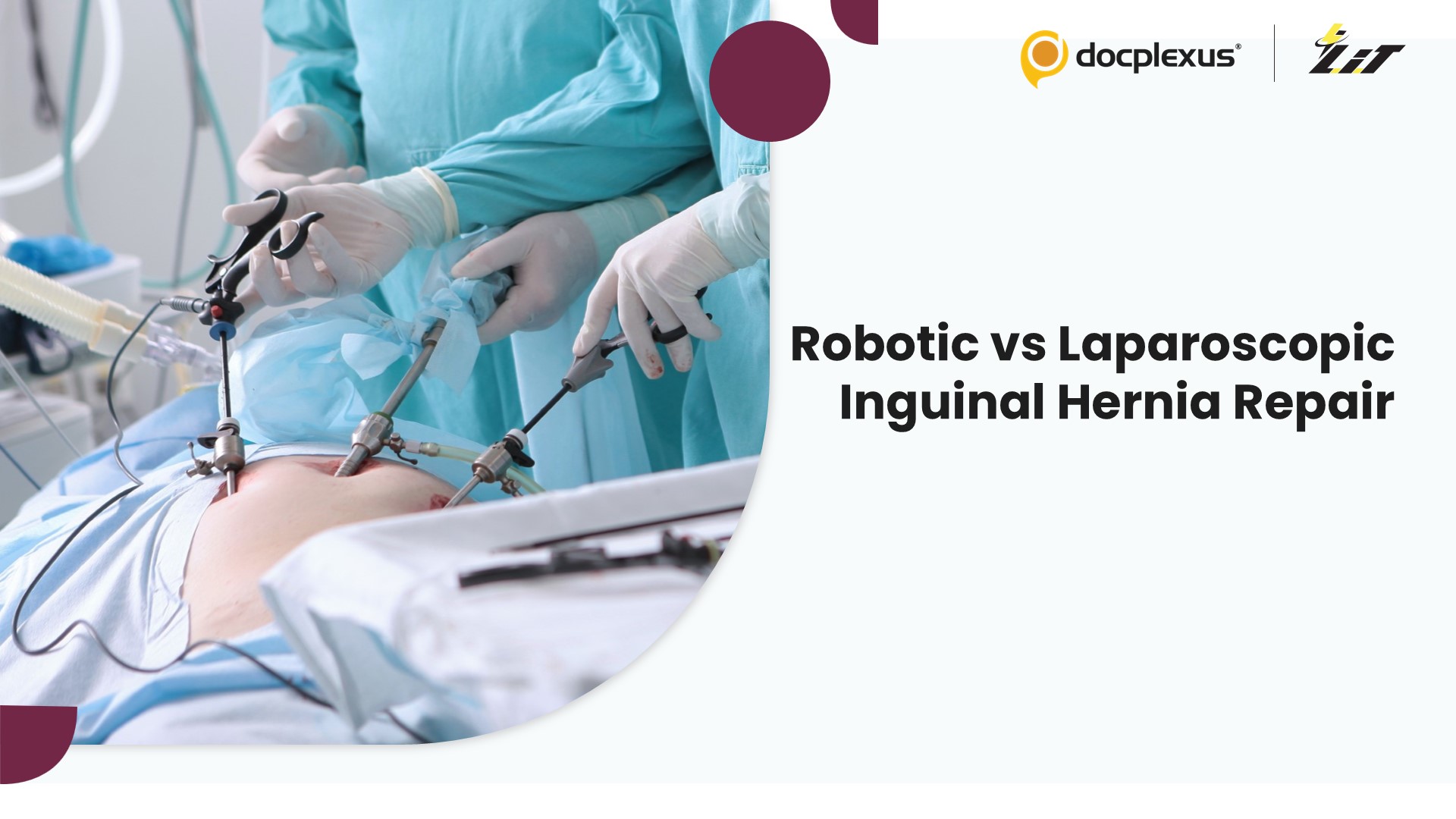 Robotic Transabdominal Preperitoneal Repair Versus Laparoscopic Totally Extraperitoneal Repair for Inguinal Hernia Surgery
