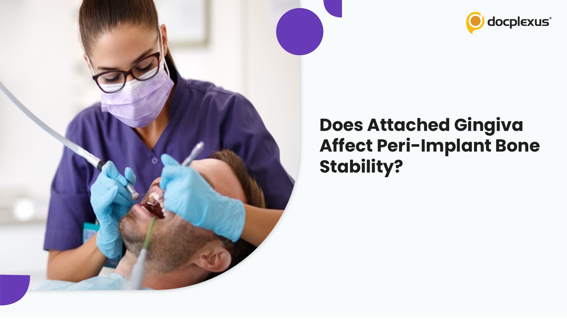 From Soft Tissue to Stability: Does Attached Gingiva Truly Influence Peri-Implant Bone Loss?