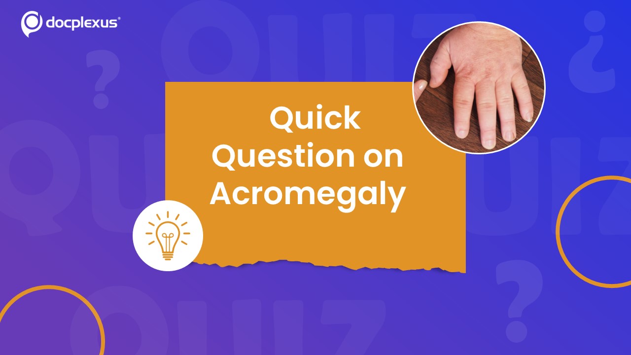 Think You Know Acromegaly? Quick Endocrinology Quiz