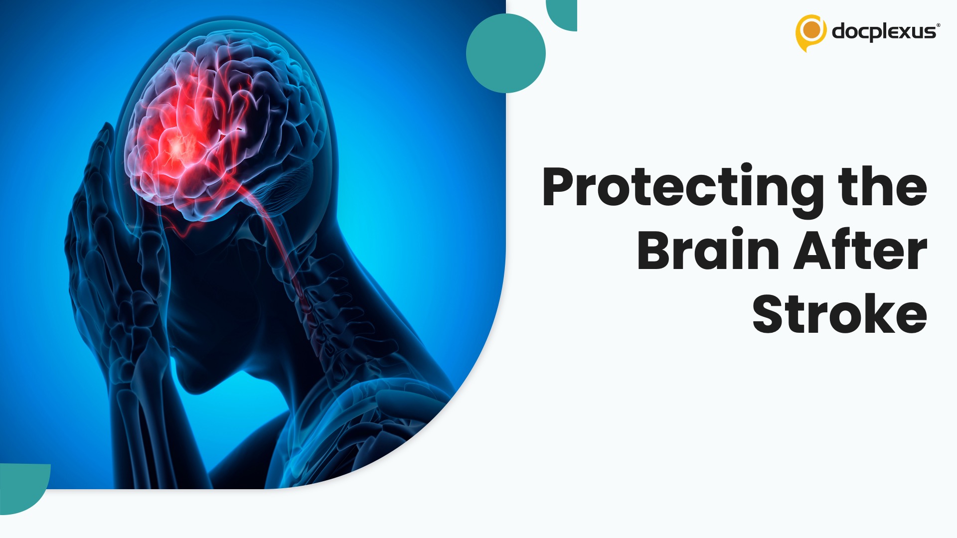 Stroke Prevention and Cognition: Shaping Long-Term Brain Health After Stroke