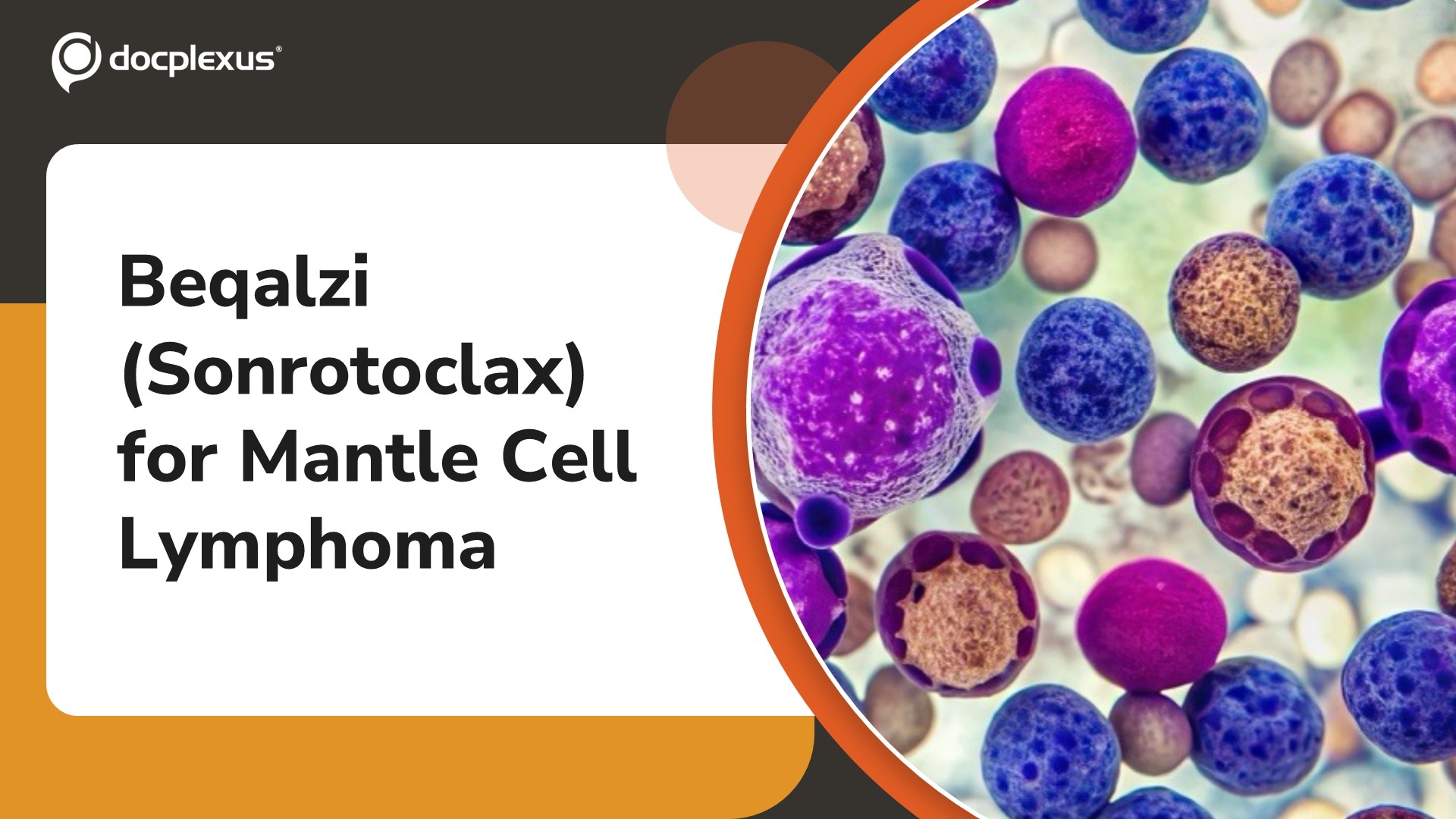 USFDA Grants Accelerated Approval to Beqalzi (Sonrotoclax) for Relapsed or Refractory Mantle Cell Lymphoma