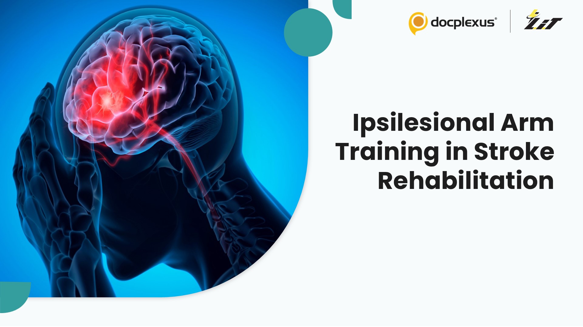 Neglected No More? Rethinking Stroke Rehabilitation Through Ipsilesional Arm Training