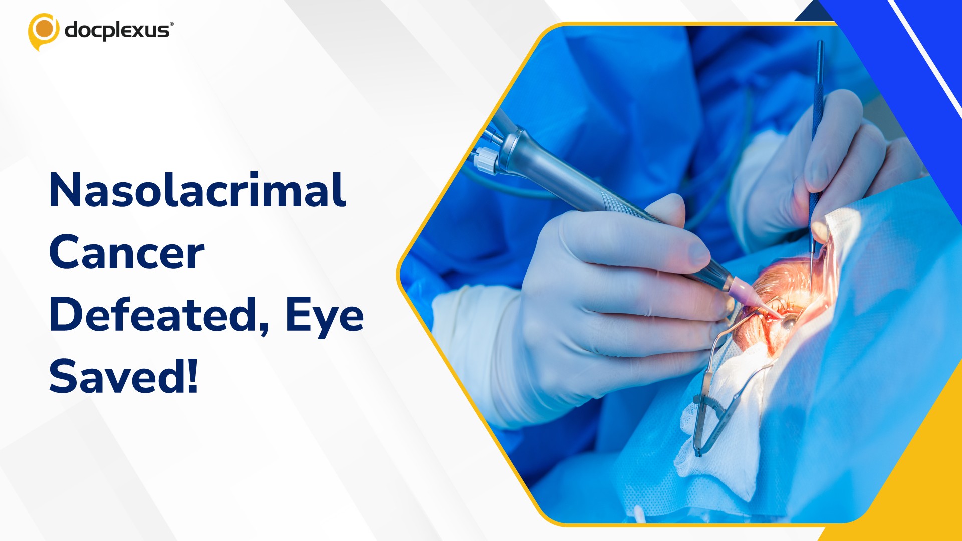 Rare Nasolacrimal Apparatus Cancer Successfully Treated at a Pune Hospital