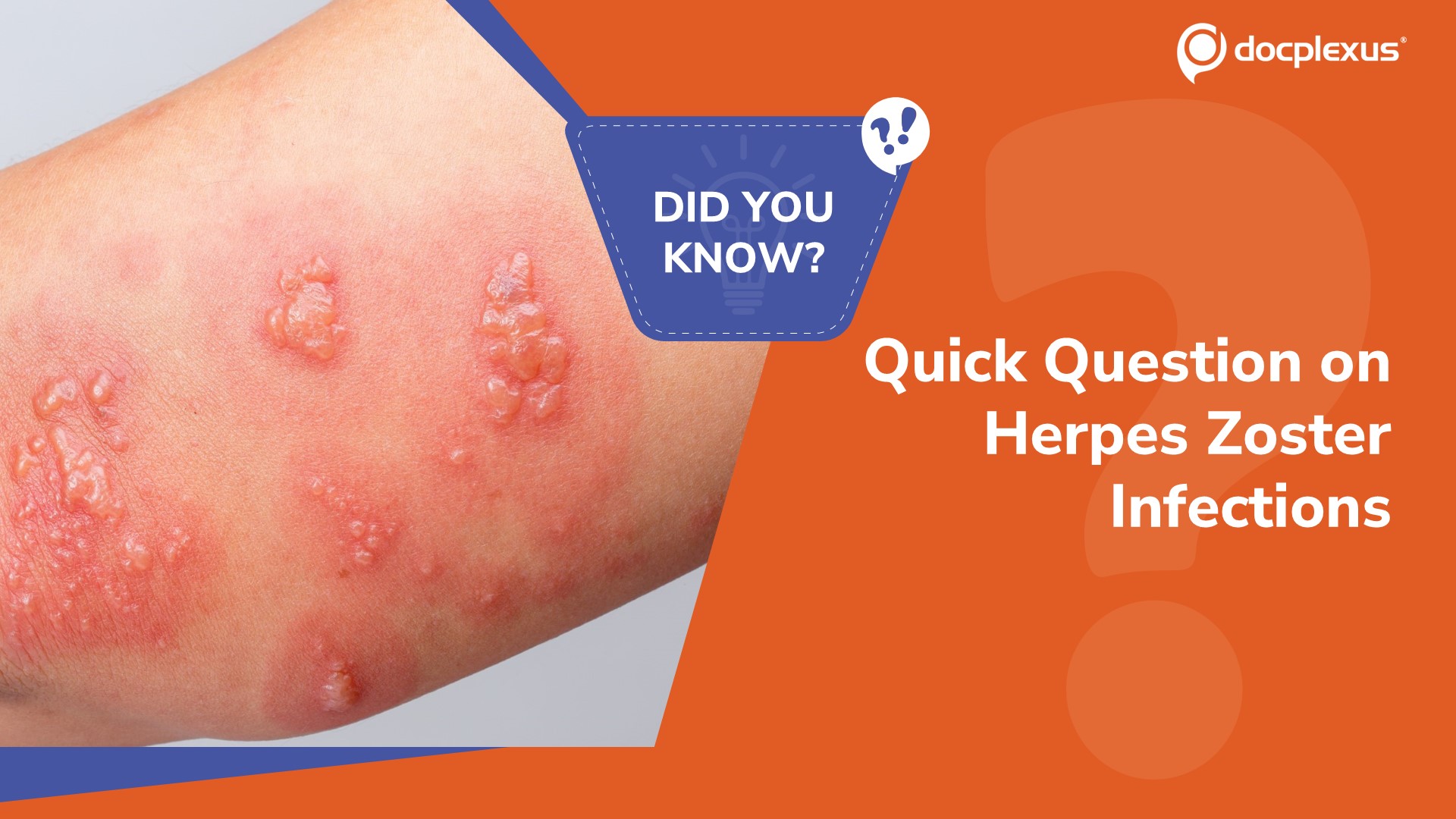 Think You Know Herpes Zoster Infections? Quick Dermatology Quiz